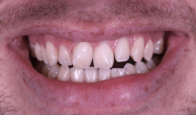 Before - Dr Nina Shaffie