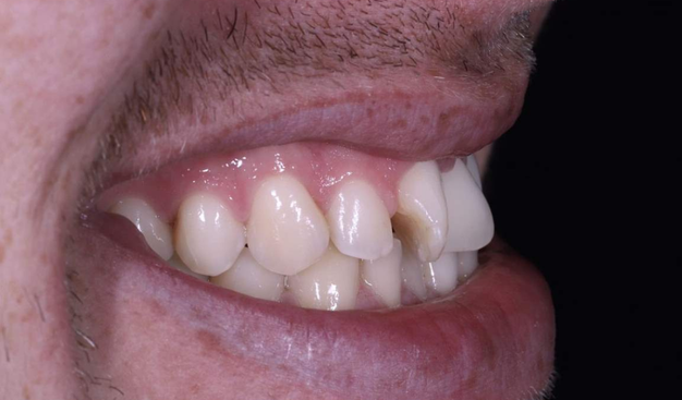 Before - Dr Nina Shaffie