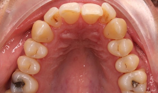 Before - Dr Nina Shaffie