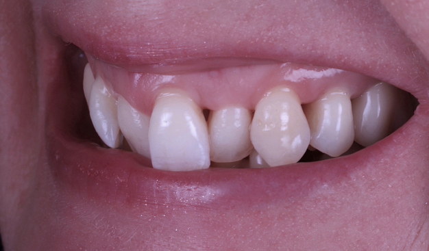 Before - Dr Nina Shaffie