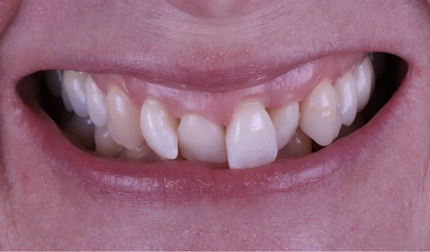 Before - Dr Nina Shaffie