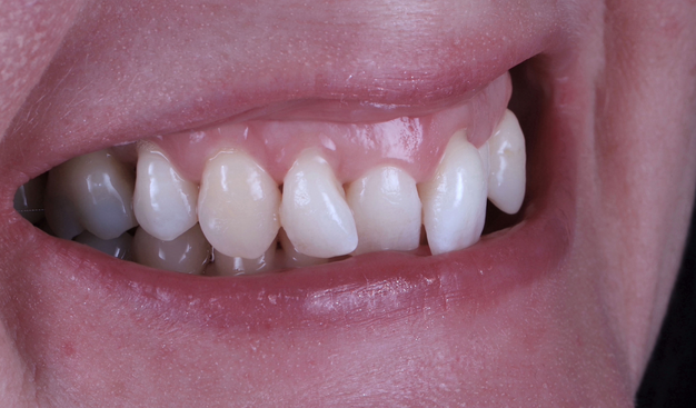 Before - Dr Nina Shaffie