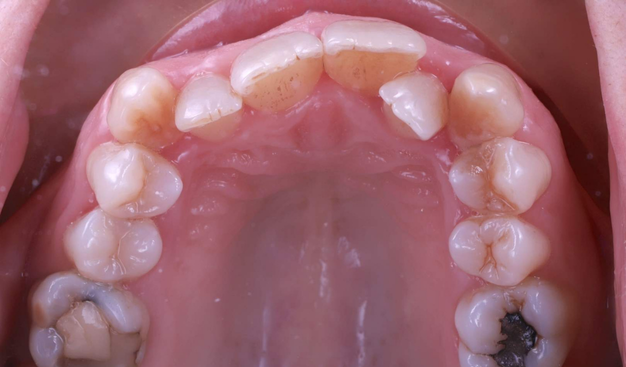 Before - Dr Nina Shaffie