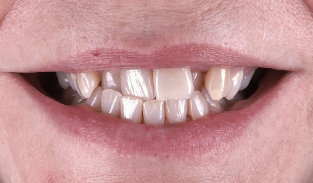 Before - Dr Nina Shaffie