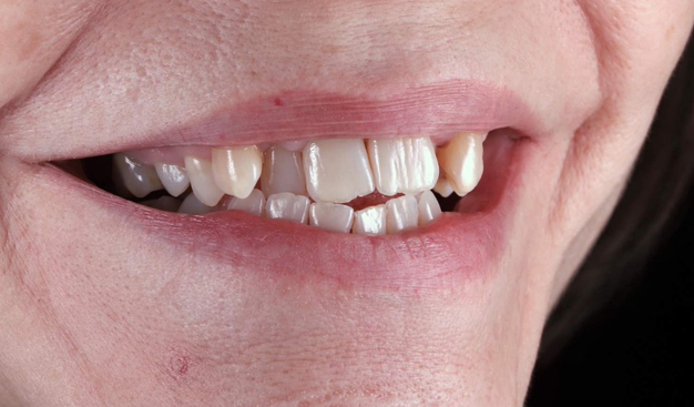 Before - Dr Nina Shaffie