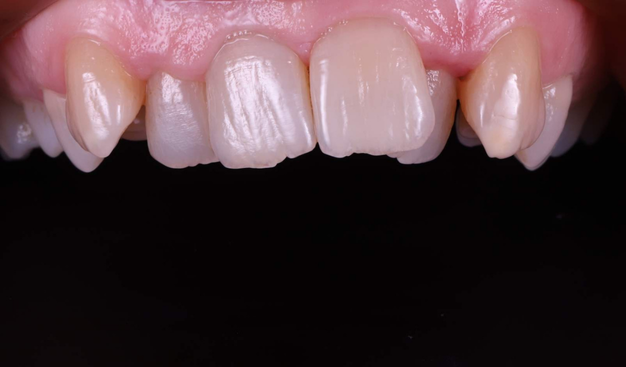 Before - Dr Nina Shaffie