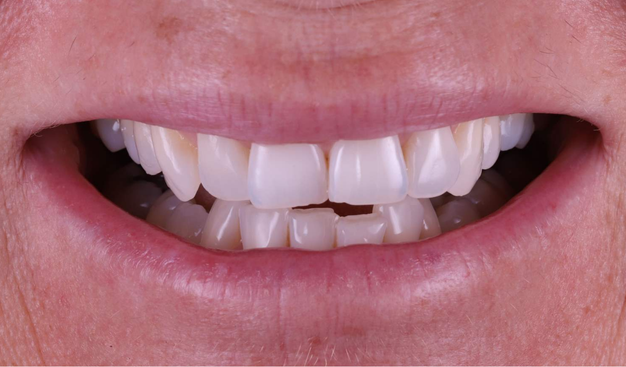 Before - Dr Nina Shaffie