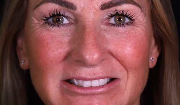 Before - Dr Nina Shaffie