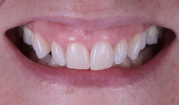 Before - Dr Nina Shaffie