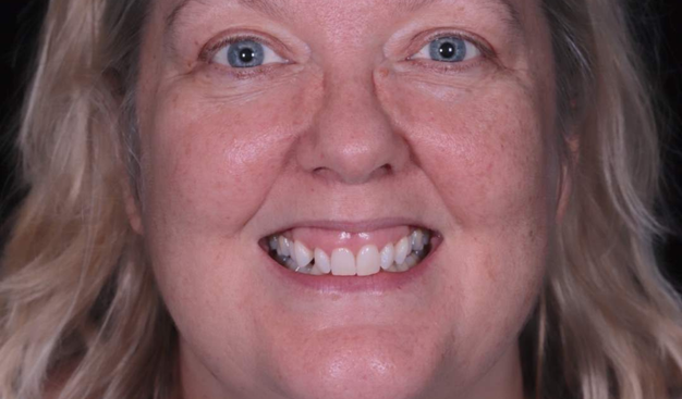 Before - Dr Nina Shaffie