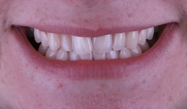 Before - Dr Nina Shaffie