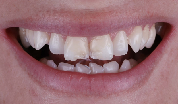 Before - Dr Nina Shaffie