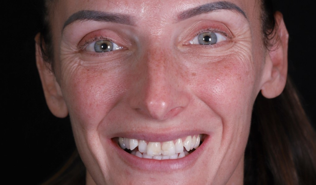 Before - Dr Nina Shaffie