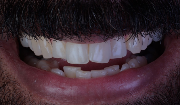 Before - Dr Nina Shaffie