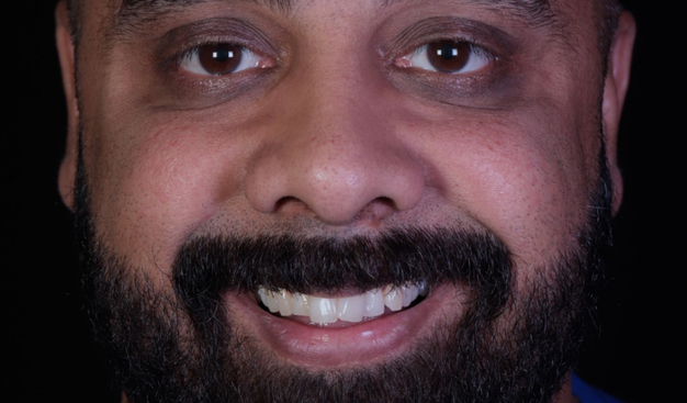 Before - Dr Nina Shaffie