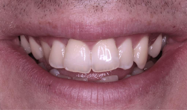 Before - Dr Nina Shaffie