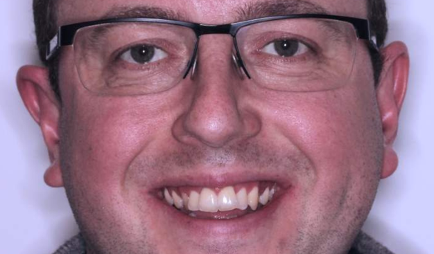 Before - Dr Nina Shaffie