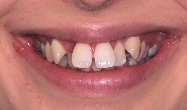 Before - Dr Nina Shaffie