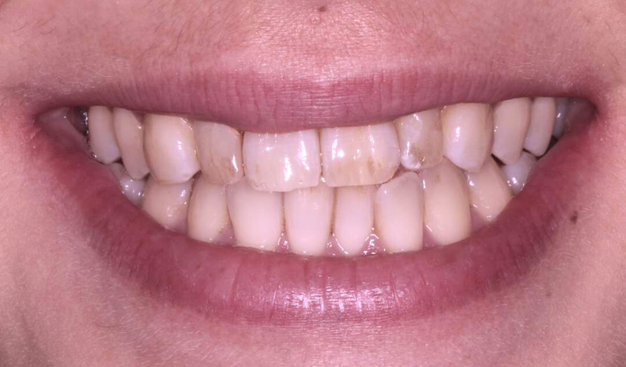 Before - Dr Nina Shaffie