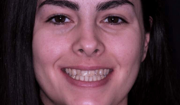 Before - Dr Nina Shaffie