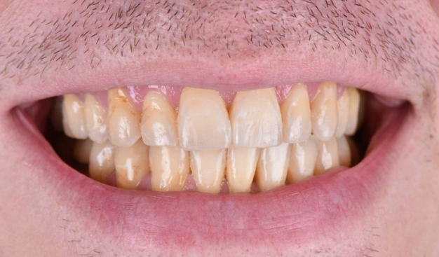 Before - Dr Nina Shaffie