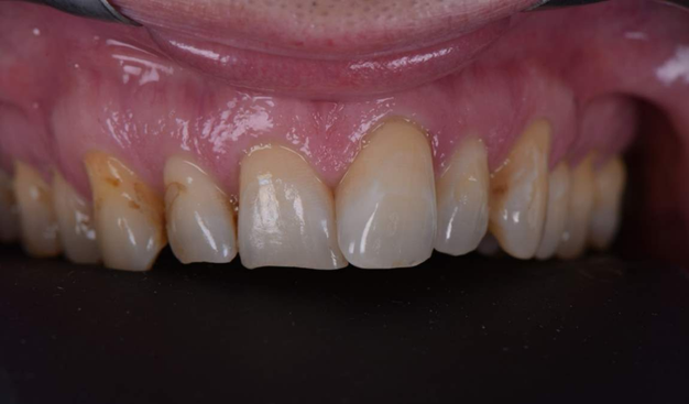 Before - Dr Nina Shaffie