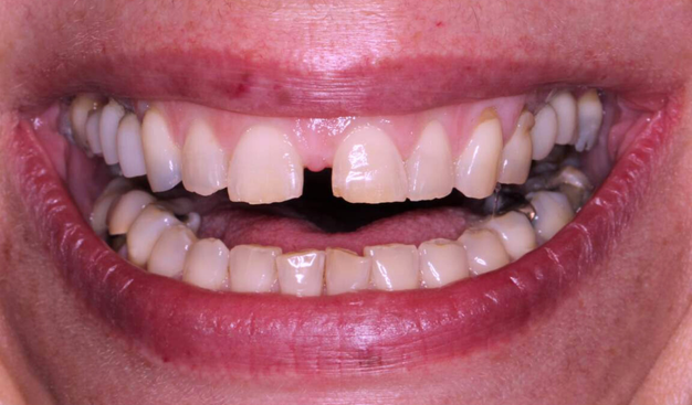 Before - Dr Nina Shaffie