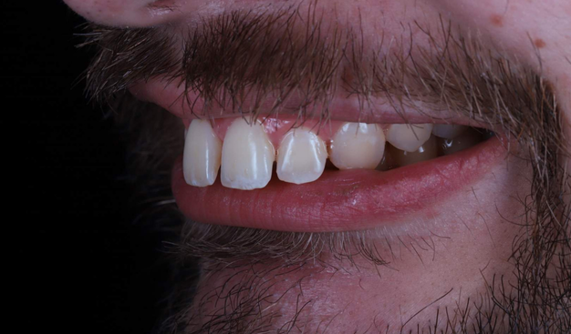 Before - Dr Nina Shaffie