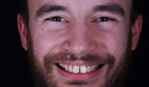 Before - Dr Nina Shaffie