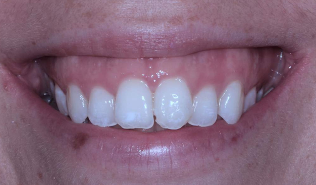 Before - Dr Nina Shaffie