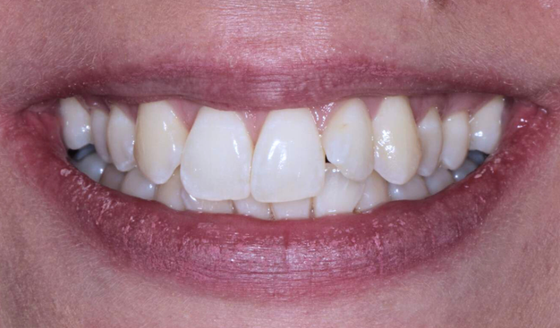 Before - Dr Nina Shaffie