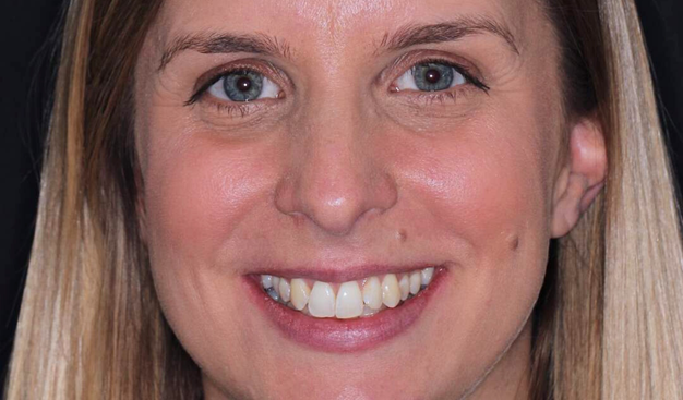 Before - Dr Nina Shaffie