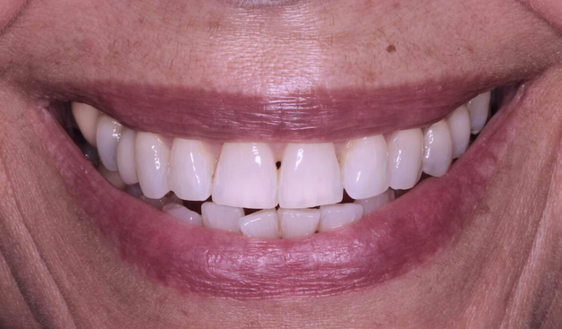 Before - Dr Nina Shaffie