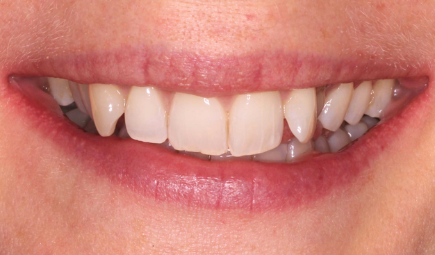 Before - Dr Nina Shaffie