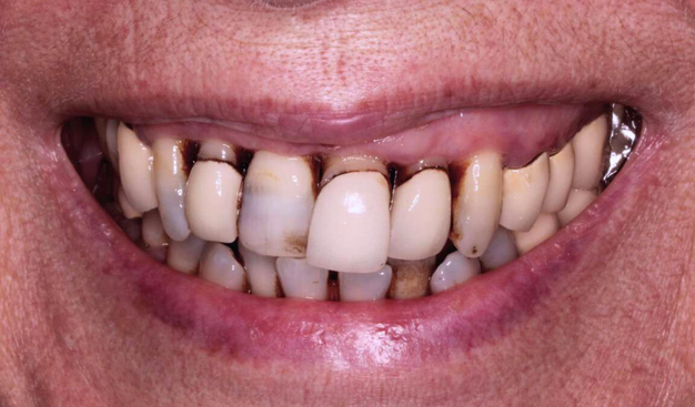 Before - Dr Nina Shaffie