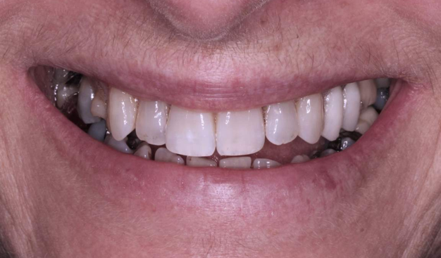 Before - Dr Nina Shaffie