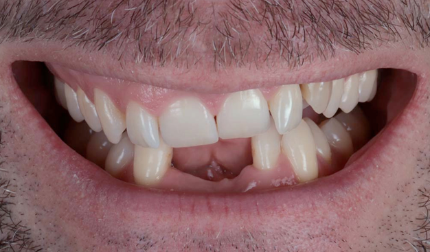 Before - Dr Nina Shaffie