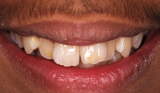 Before - Dr Nina Shaffie