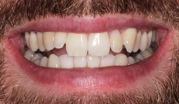 Before - Dr Nina Shaffie