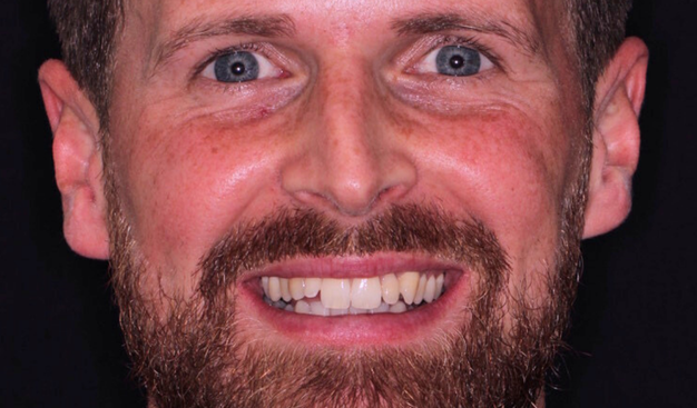 Before - Dr Nina Shaffie