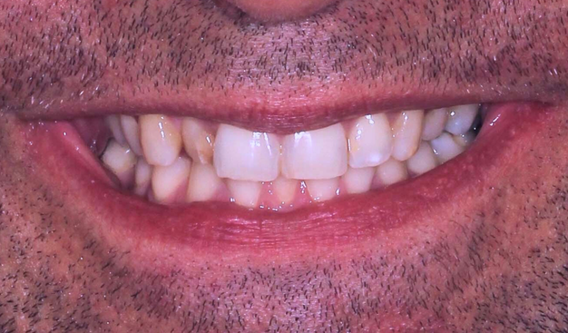 Before - Dr Nina Shaffie