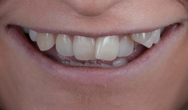 Before - Dr Nina Shaffie