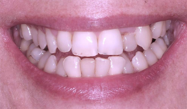 Before - Dr Nina Shaffie