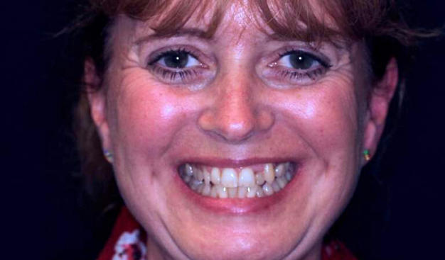 Before - Dr Nina Shaffie