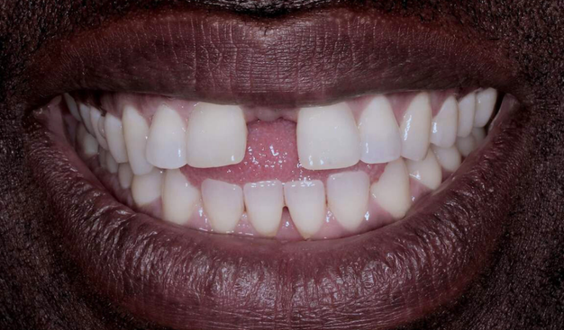 Before - Dr Nina Shaffie