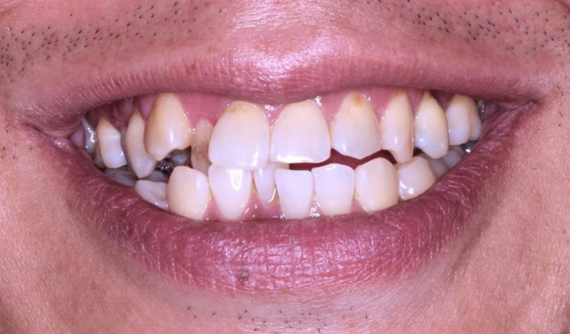 Before - Dr Nina Shaffie