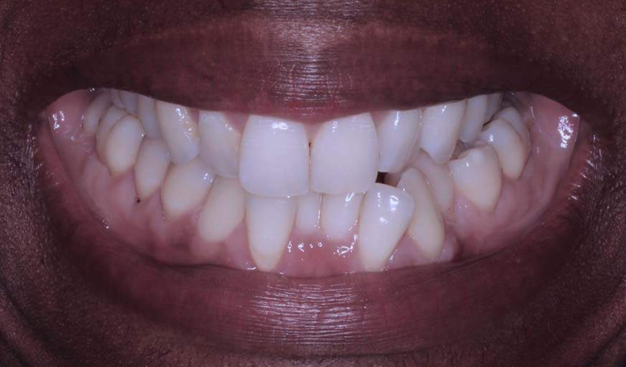 Before - Dr Nina Shaffie