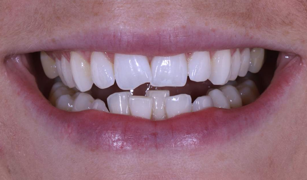 Before - Dr Nina Shaffie