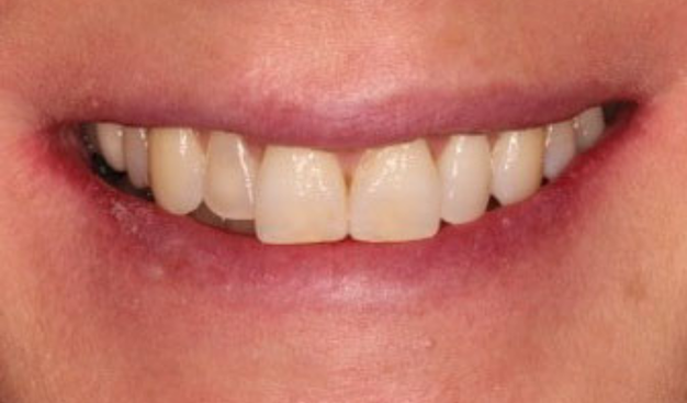 Before - Dr Nina Shaffie