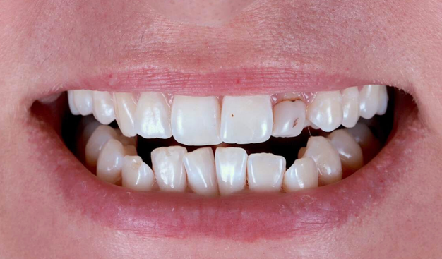 Before - Dr Nina Shaffie